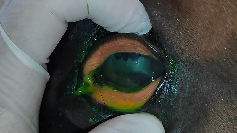 Corneal ulcer fluorescein stain